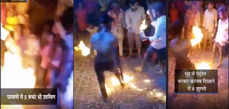 हापुड़: मुंह में पेट्रोल भर कर करतब दिखाने में लगी आग, 5 बच्‍चों समेत आठ झुलसे; जन्माष्टमी कार्यक्रम में हुआ हादसा