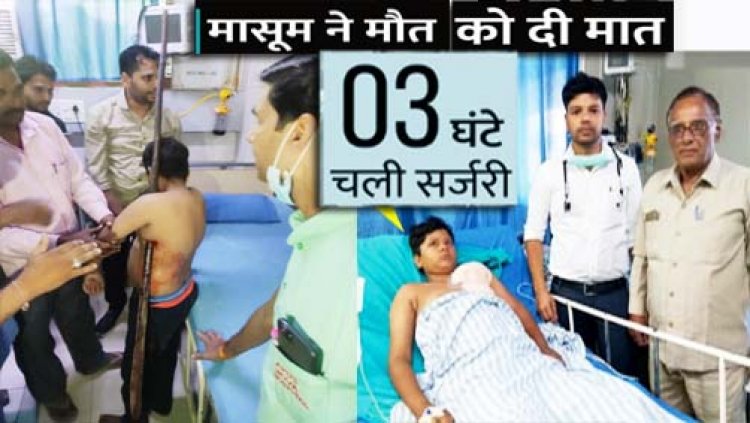 12 साल के बच्चे ने मौत को मात दे दी :  छत से 7 फीट लंबे बांस पर गिरा था 12 साल का बच्चा, 3 घंटे तक चली सर्जरी