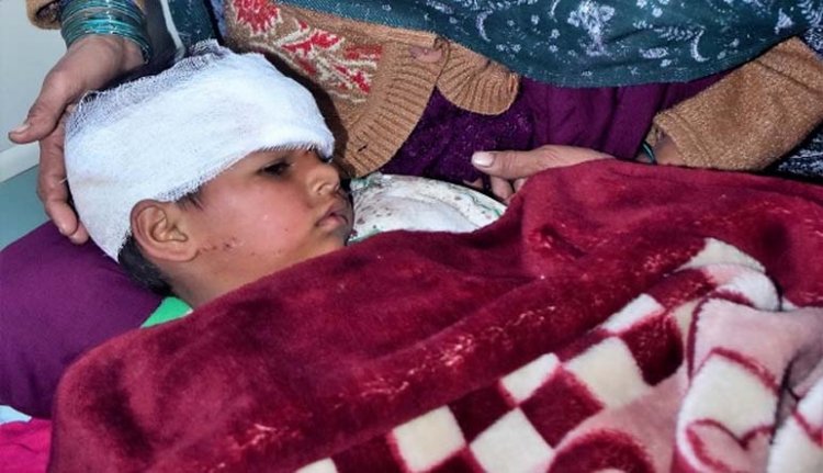 मुरादाबाद के थाना डिलारी में अज्ञात जानवर  के हमले से फैली दहशत : हमले में 9 ग्रामीण घायल,तेंदुए की हमले की अफवाह से पूरे गांव में हड़कंप