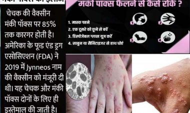 मंकीपॉक्स को लेकर अलर्ट के बाद बढ़ रहे डॉक्टरों से संपर्क के मामले : SGPGI, KGMU समेत सभी चिकित्सा संस्थानों में जारी हुआ अलर्ट