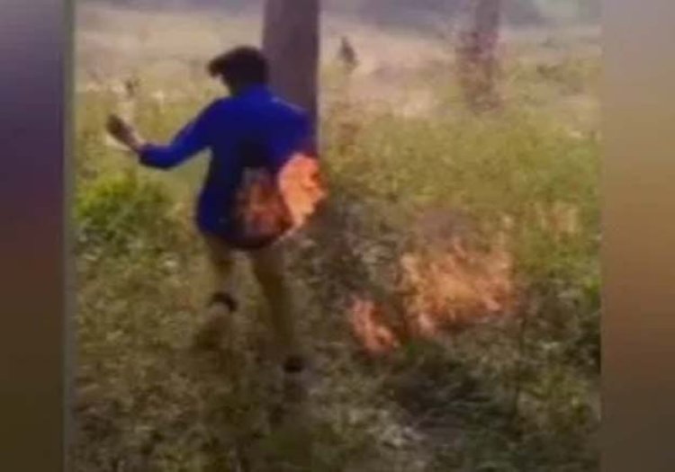 स्कूल से बंक मार पेट्रोल बम से स्टंट कर रहा था छात्र, अचानक आग से झुलसा